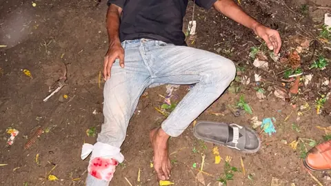 Ghaziabad Snatching Accused Fire at Police, Shot in Retaliation