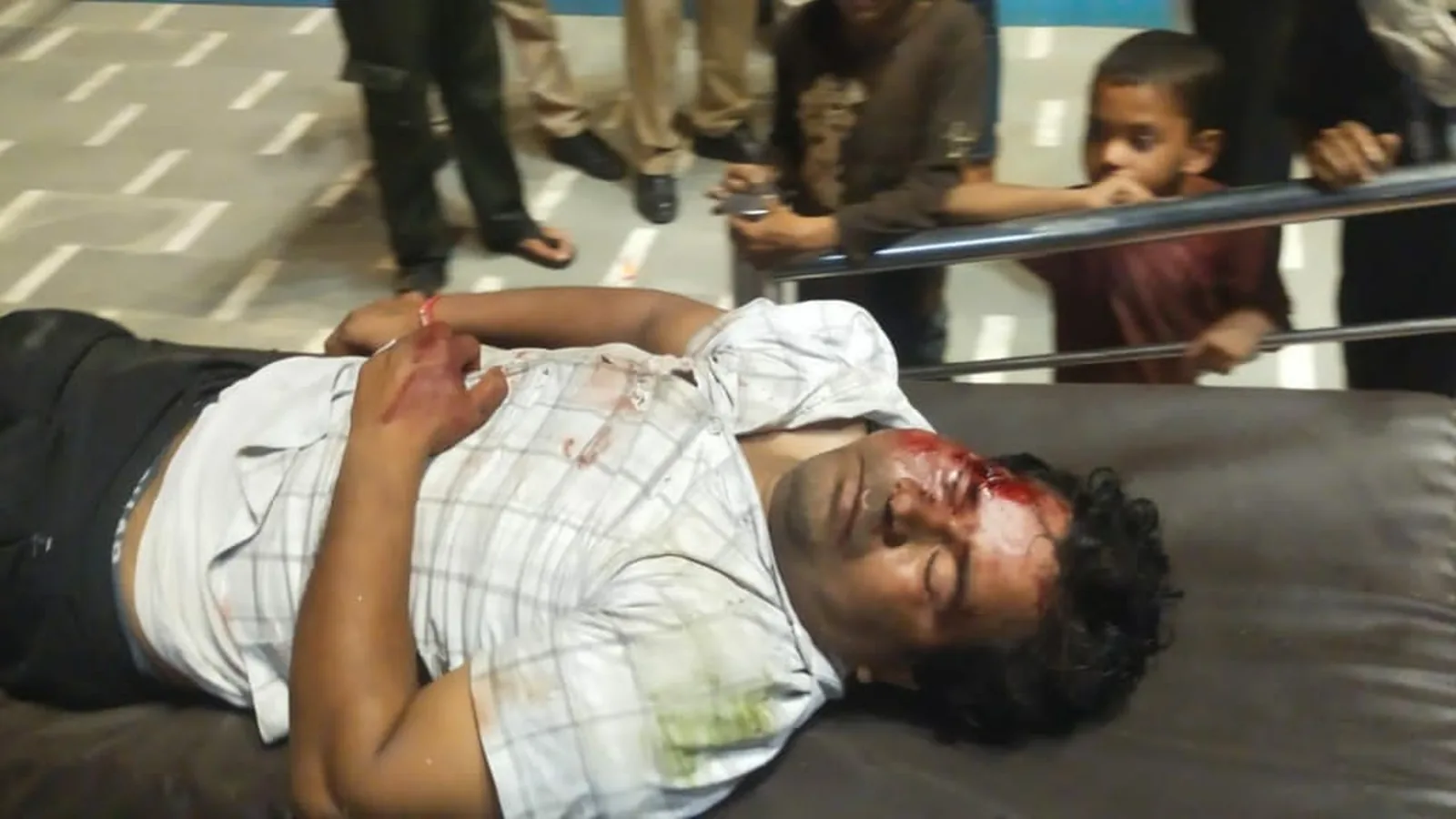 Pregnant woman injured as hit-and-run car strikes motorcycle couple in Aligarh