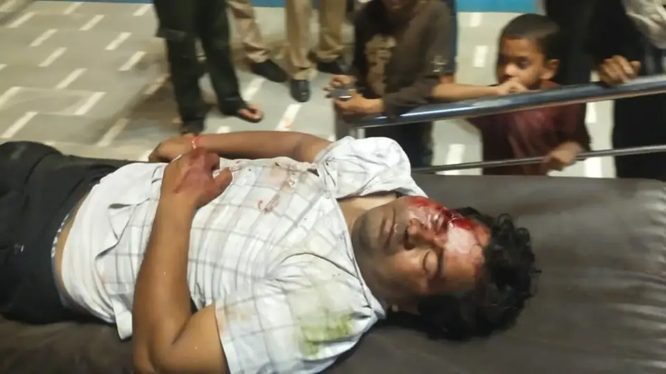 अलीगढ़ में कार ने बाइक सवार दंपत्ति को टक्कर मारी, गर्भवती पत्नी गंभीर रूप से घायल