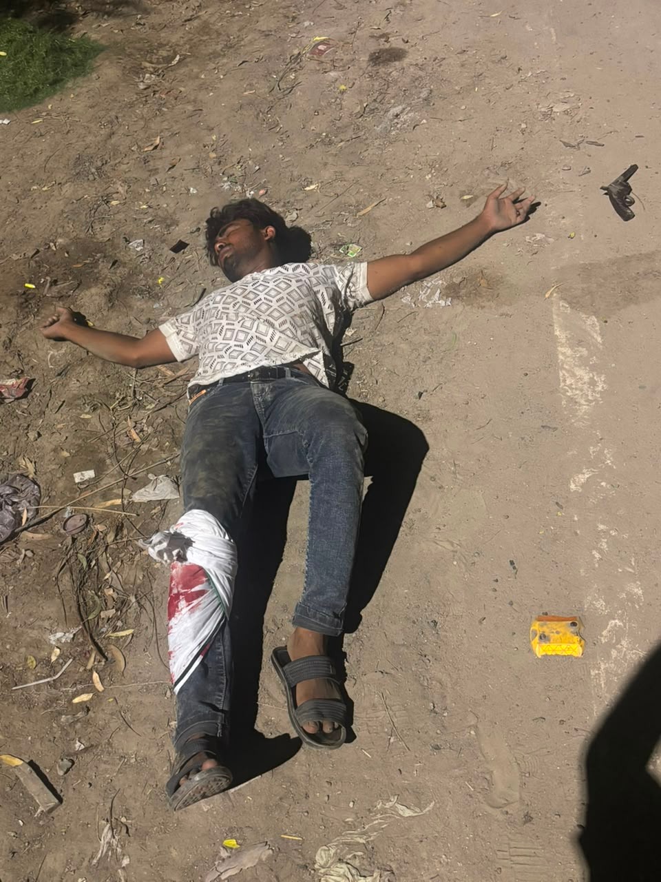 सिहानीगेट पुलिस मुठभेड़ में गिरफ्तार दो घायल आरोपी