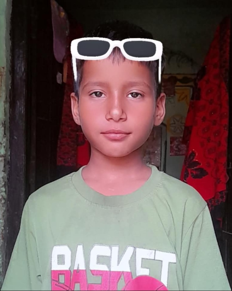 Snakebite-related case image from Ghaziabad report