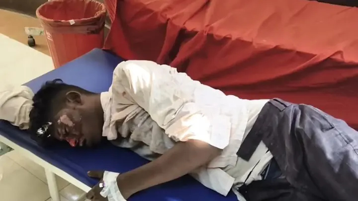 Labourer Seriously Burned After Contact With 11,000-Volt Line In Hathras