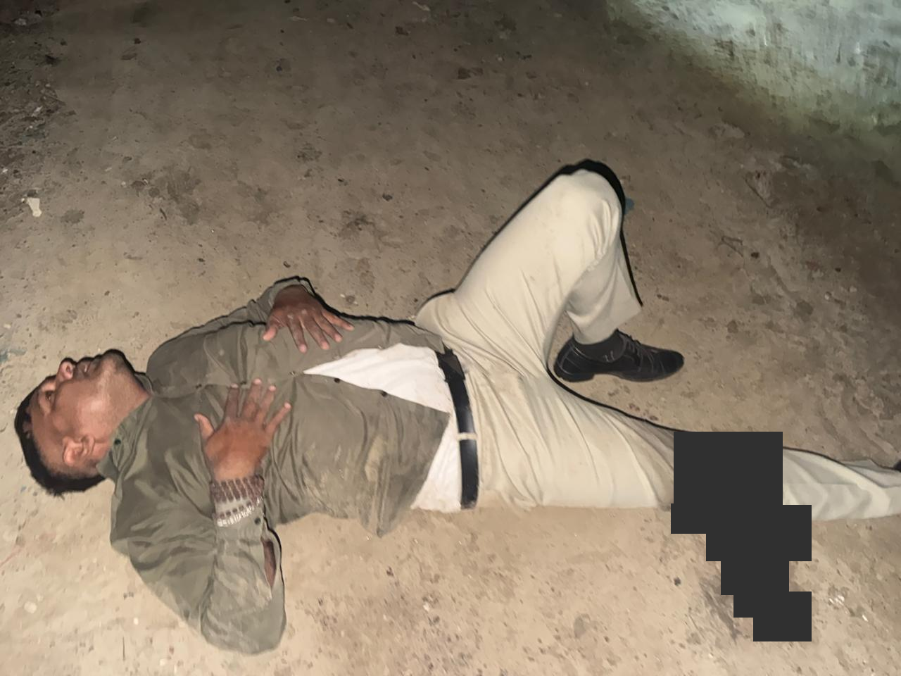 पुलिसकर्मियों के साथ घायल आरोपी की उपलब्ध कराई गई तस्वीर; चोट वाला हिस्सा ढका गया है