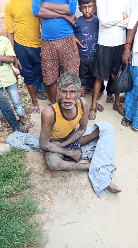 श्रावस्ती में कलयुगी बेटे ने 52 वर्षीय विकलांग पिता को बंधक बनाकर बेरहमी से पीटा।